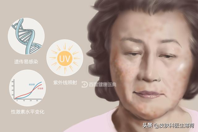 手臂上有咖啡色的斑图片，为何手臂上有很多暗沉的色斑（一文教你辨识自己长的究竟是啥斑）