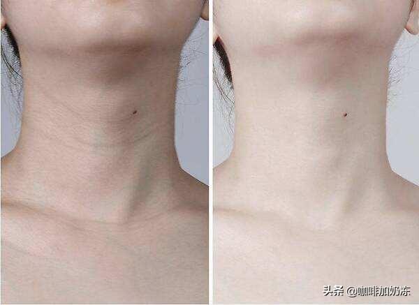 磨砂膏能用在胸上吗，磨砂膏可以涂胸吗（我的室友们手不停蹄地盘我）