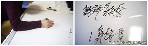 特发性震颤治好案例（刘伟钦团队）