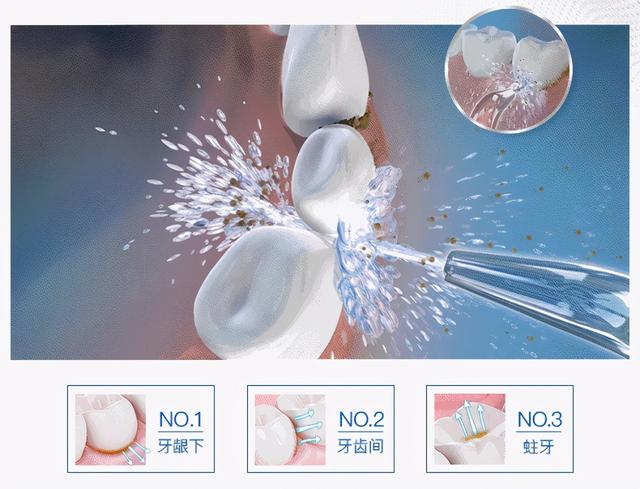 牙线的正确使用方法图片，牙线使用说明（三种牙线的正确使用方法对比）