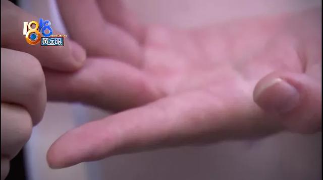 男人戴戒指的含义，男人戴戒指的含义是什么（男朋友戴女戒手指脱皮）