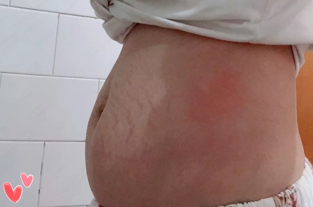 产后如何保养脸部皮肤，产后怎样保养脸部皮肤（帮助宝妈恢复风采）