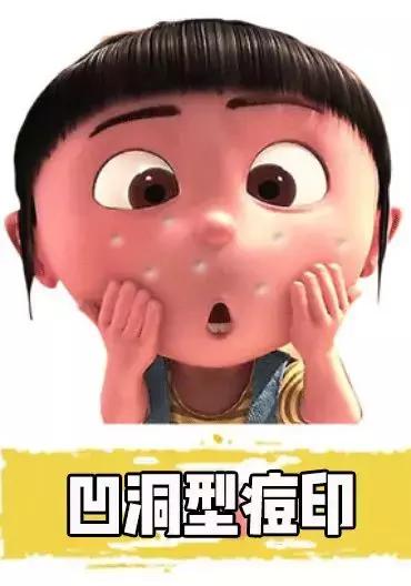 什么药膏可以祛痘,痘痘可以用什么药膏(到药店买这6种小药膏。平价有效) 什么药膏可以祛痘,痘痘可以用什么药膏(到药店买这6种小药膏。平价有效)