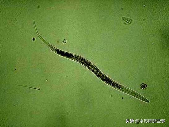 微生物镜检标准是多少，污水处理厂微生物镜检流程与污泥活性分析总结