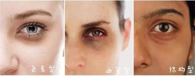 雅诗兰黛眼霜好用吗，雅诗兰黛红石榴球型眼霜好用吗（雅诗兰黛新款抗蓝光眼霜真这么厉害）