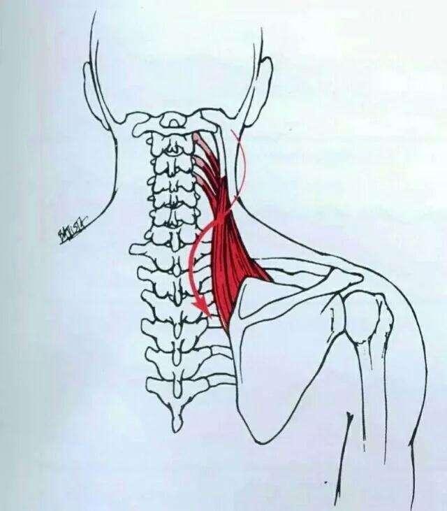 溜肩怎么练成平肩，男生溜肩怎么练成平肩（上斜方肌受着不可承受之重。选对方法）