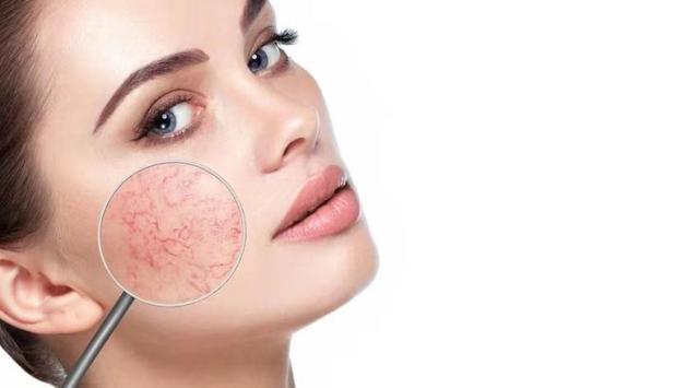 去角质产品哪个好，去角质的产品排名榜（轻松还你白嫩肌肤）