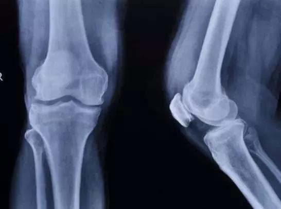 人有几根肋骨，人有几根肋骨女（人类骨骼的冷知识）