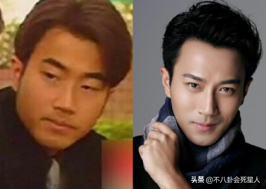 傅明宪双眼皮是割的，傅明宪（但这5位演员“换头逆袭”）