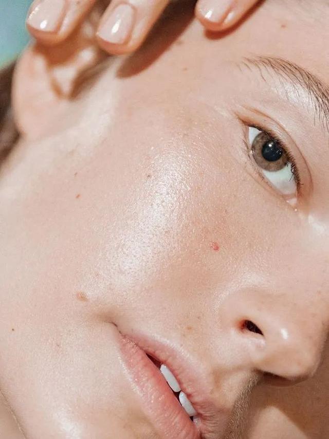 戴口罩会闷痘痘吗，长期戴口罩会不会捂出痘痘（开启紧急防护戳这里）