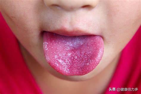 宝宝长疹子的大致判断，宝宝长疹子症状（宝宝身上长疹子）