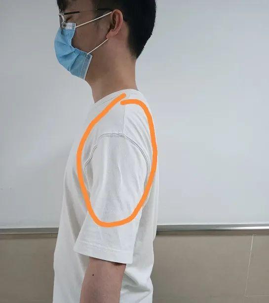 肩周炎三个动作自愈方法视频，肩周炎三个动作自愈方法（他得了两年的肩周炎竟然好了）