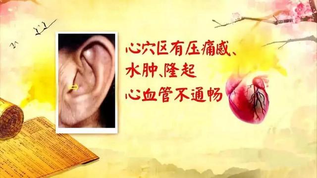 耳珠是哪个部位，耳朵长痣的位置图解（身体好不好，看“脸”就知道）