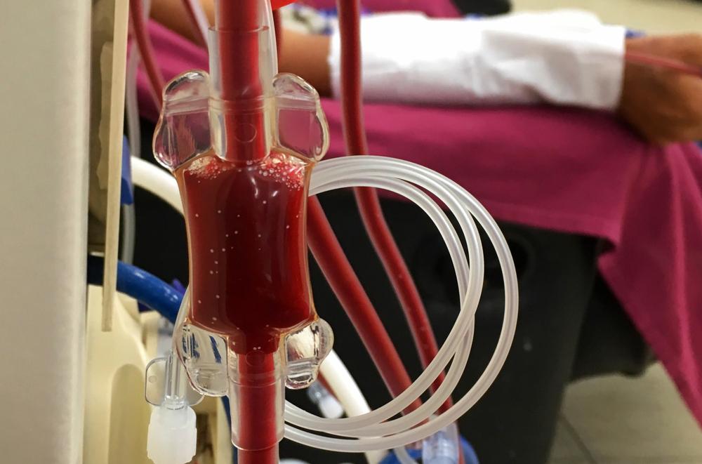 做一个心脏造影多少钱(冠心病都要心脏造影) - 价格百科