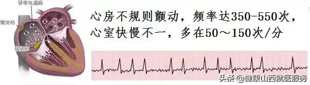 正常人心率是多少，正常人心率是多少呢（专家喊你赶紧去医院）