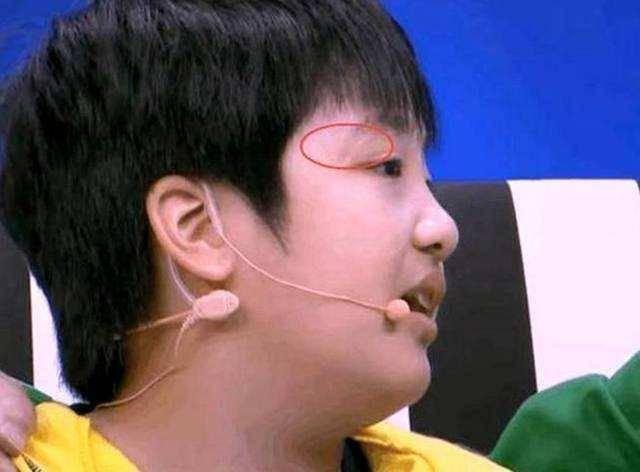 近年来综艺事故及涉及艺人，吴镇宇儿子眼角的伤疤如今还在