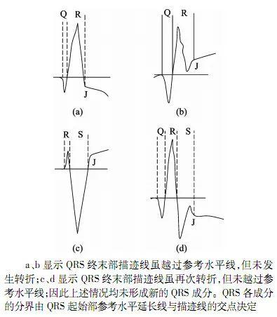 qtc间期正常值，心电图qt和qtc间期正常是多少毫秒