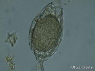 微生物镜检标准是多少，污水处理厂微生物镜检流程与污泥活性分析总结