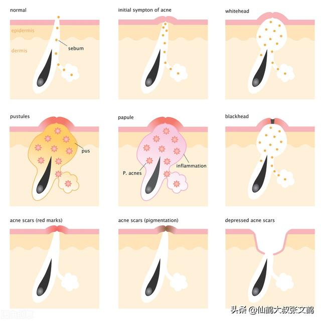 十滴水洗脸功效与作用，十滴水的功效与作用是什么（各种去黑头偏方真的有效吗）