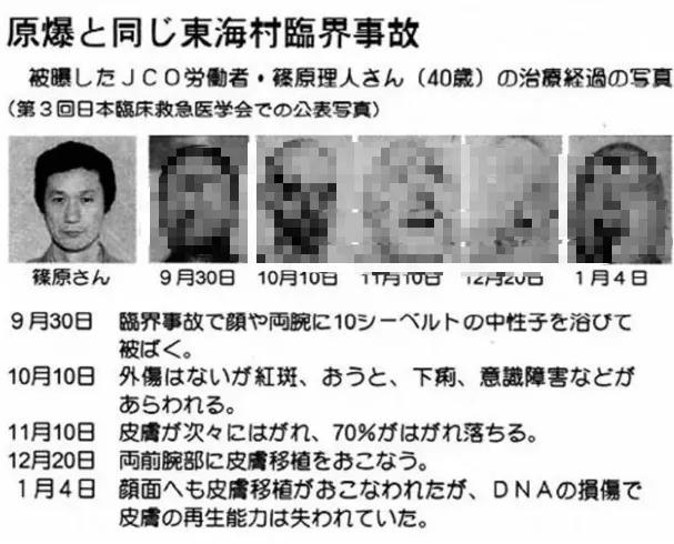 日本东海村核临界事故，日本东海村核临界事故百科（核辐射惨烈堪比十八层地狱）