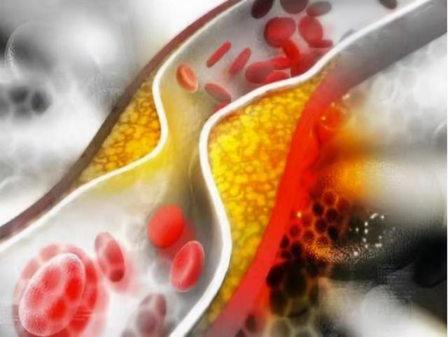 荷叶山楂陈皮泡水喝的功效，荷叶山楂膏喝了有什么功效（高血压病、高血脂症、脂肪肝）