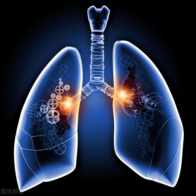 肺气肿一般能活几年，肺气肿能活多少年（晚期肺气肿存活率不到5成）