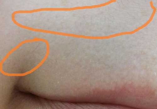 胡子怎么去除，络腮胡子怎么去除（让你摆脱“胡子”尴尬）