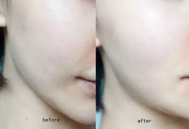 敷尔佳面膜怎么样(可复美面膜真的好用吗)