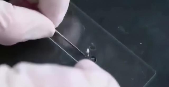 满虫咬皮肤是什么样子求图，螨虫咬的包是啥样子（3看轻松判断脸上是有螨虫）
