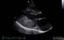 虎纹猫是什么品种是家猫吧，虎斑猫是什么品种（小小的身材居然有这么多的种族遗传病）