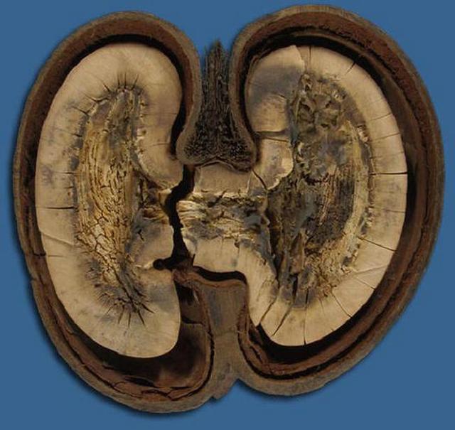 巨型猪笼草的简介，巨型猪笼草的简介和特点（世界上即神秘有神奇的植物）