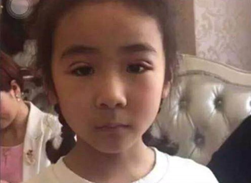 割双眼皮成功案例图片（宝妈为让女儿更漂亮）