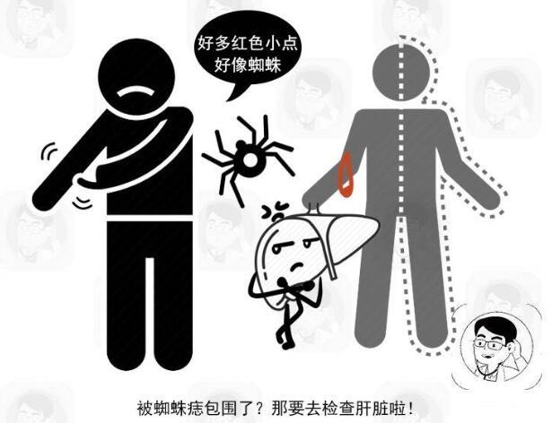 真正的朱砂痣图片，朱砂痣是什么样子（“朱砂痣”是肝硬化到来的表现吗）