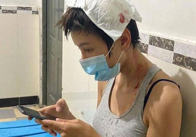 林志玲坠马事件(林志玲坠马事件言承旭探望)