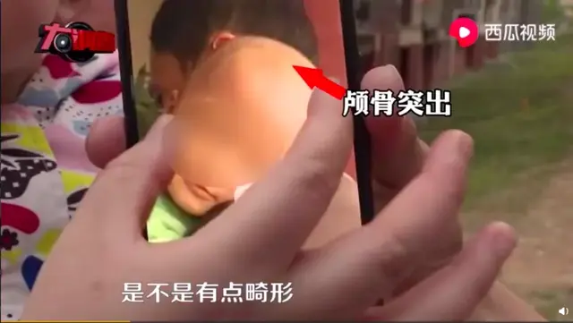 三鹿奶粉事件中存活的奶粉，12年后又现大头娃娃