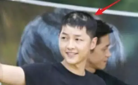 松针能生发吗，松针能治疗脱发吗（一直熬夜一直爽）