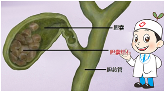 胆囊切除后不能吃的十种食物，胆囊切除后的饮食禁忌（胆囊切除后的4个注意事项）