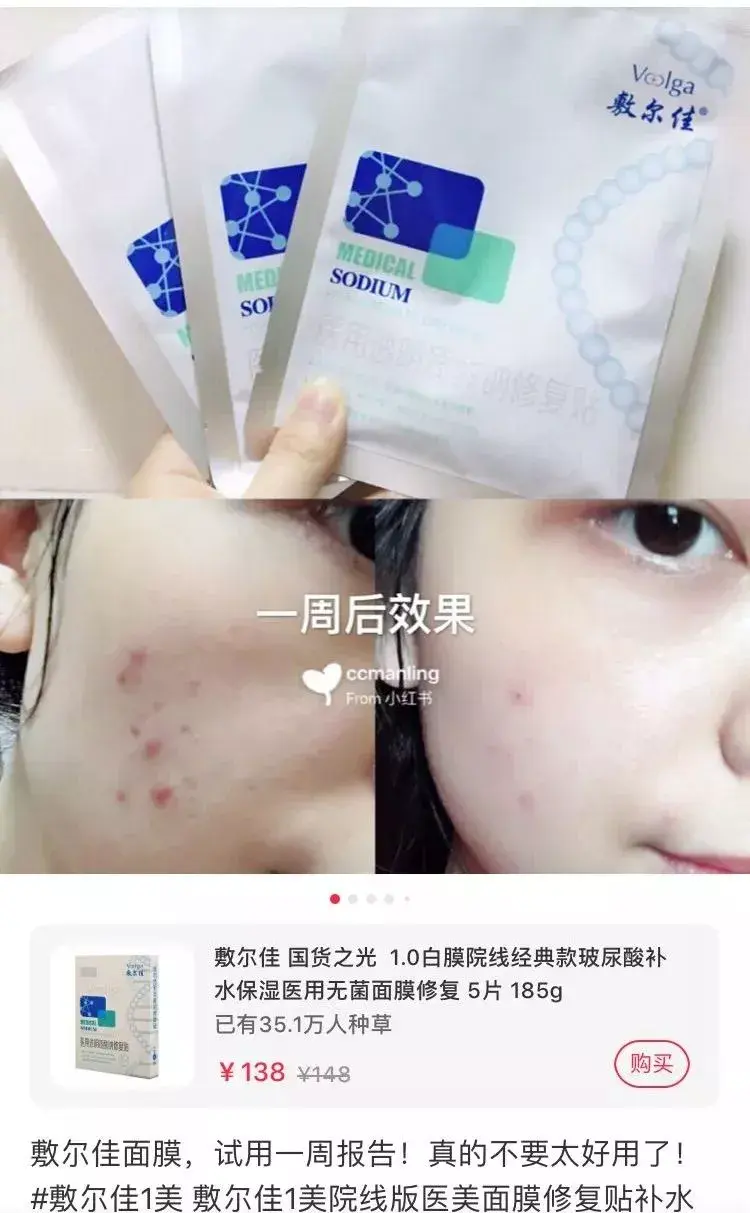敷尔佳面膜(保湿面膜哪个牌子最好)