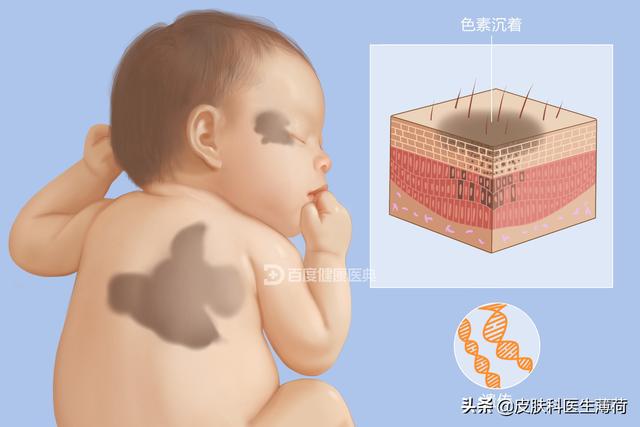 手臂上有咖啡色的斑图片，为何手臂上有很多暗沉的色斑（一文教你辨识自己长的究竟是啥斑）