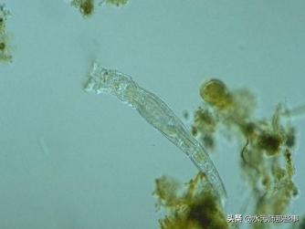 微生物镜检标准是多少，污水处理厂微生物镜检流程与污泥活性分析总结