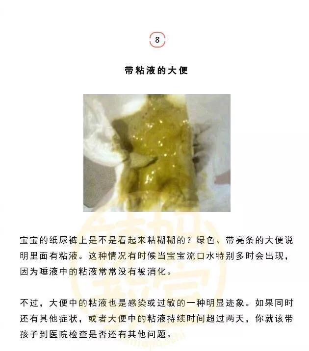 婴儿大便颜色常识图解，婴儿大便颜色常识图解5月龄宝宝大便次数（易引起不适>劝你做好心理准备再看）