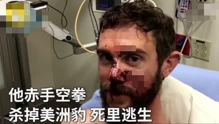肘击有多大的威力，肘击怎样威力大（对方的头骨都可能会被干裂）