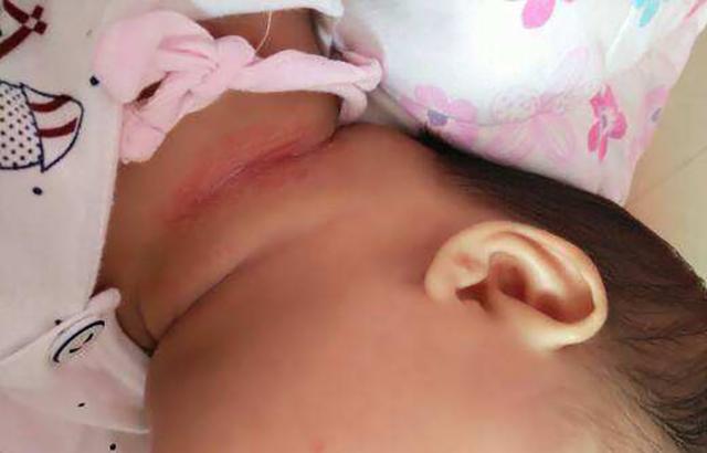 爽身粉有什么用，爽身粉还有什么用（宝妈们才能用对它）