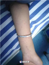 虎尾兰的功效与作用，虎尾兰的功效与作用及性味（专家：蜘蛛毒性莫小看）