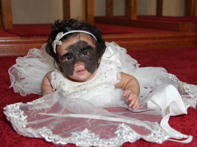 光敏印章怎么加油，原子公章和光敏章的区别（萌娃因“蝙蝠侠”胎记遭网暴）