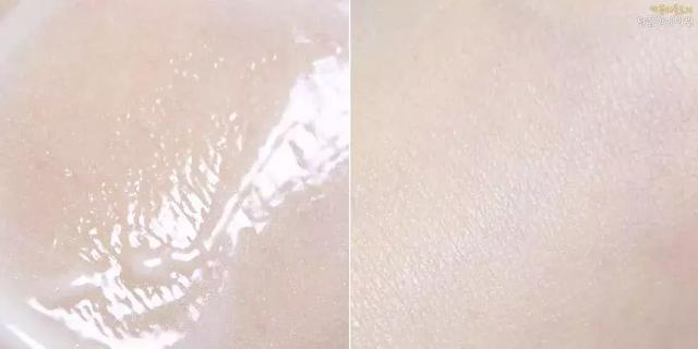 哪里有打美白针的，选对美白精华就能稳赢（哪里有美白针可以打）