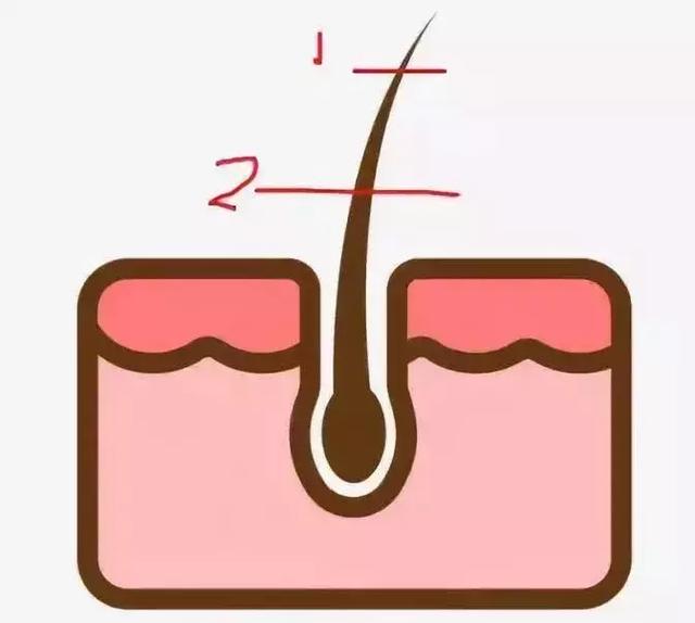 怎么永久脱腿毛，怎样永久脱腿毛（最最最最有效的居然是这一种）