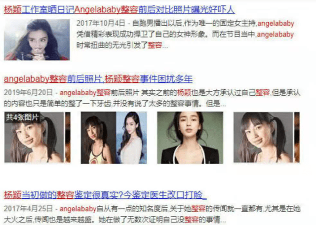杨颖旧照曝光，烟熏眼妆黑浓太个性，曾承认戴牙套整牙