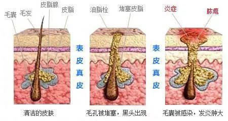 羊奶皂的使用方法，手工羊奶皂的使用方法（修护肌肤建立屏障）
