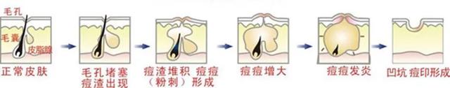 羊奶皂的使用方法，手工羊奶皂的使用方法（修护肌肤建立屏障）